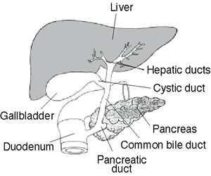 gallstone - gallbladder - cholecystitis disease