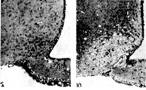 MSG damages brain at low doses